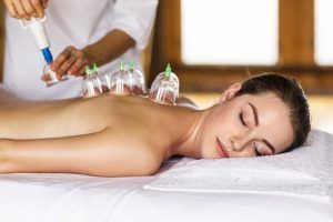 Cupping Therapy | A Beautiful You